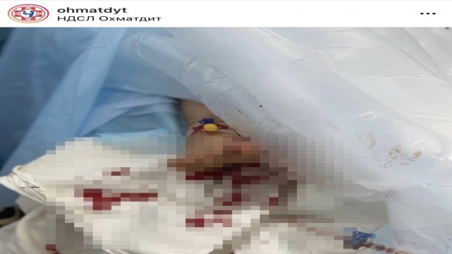 Ukrayna Büyükelçiliği, savaş mağduru ağır yaralı çocuğun fotoğraflarını paylaştı
