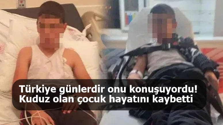 Türkiye günlerdir onu konuşuyordu! Kuduz olan çocuk hayatını kaybetti